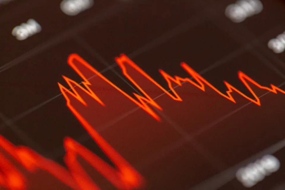 A market chart moving across a trading screen